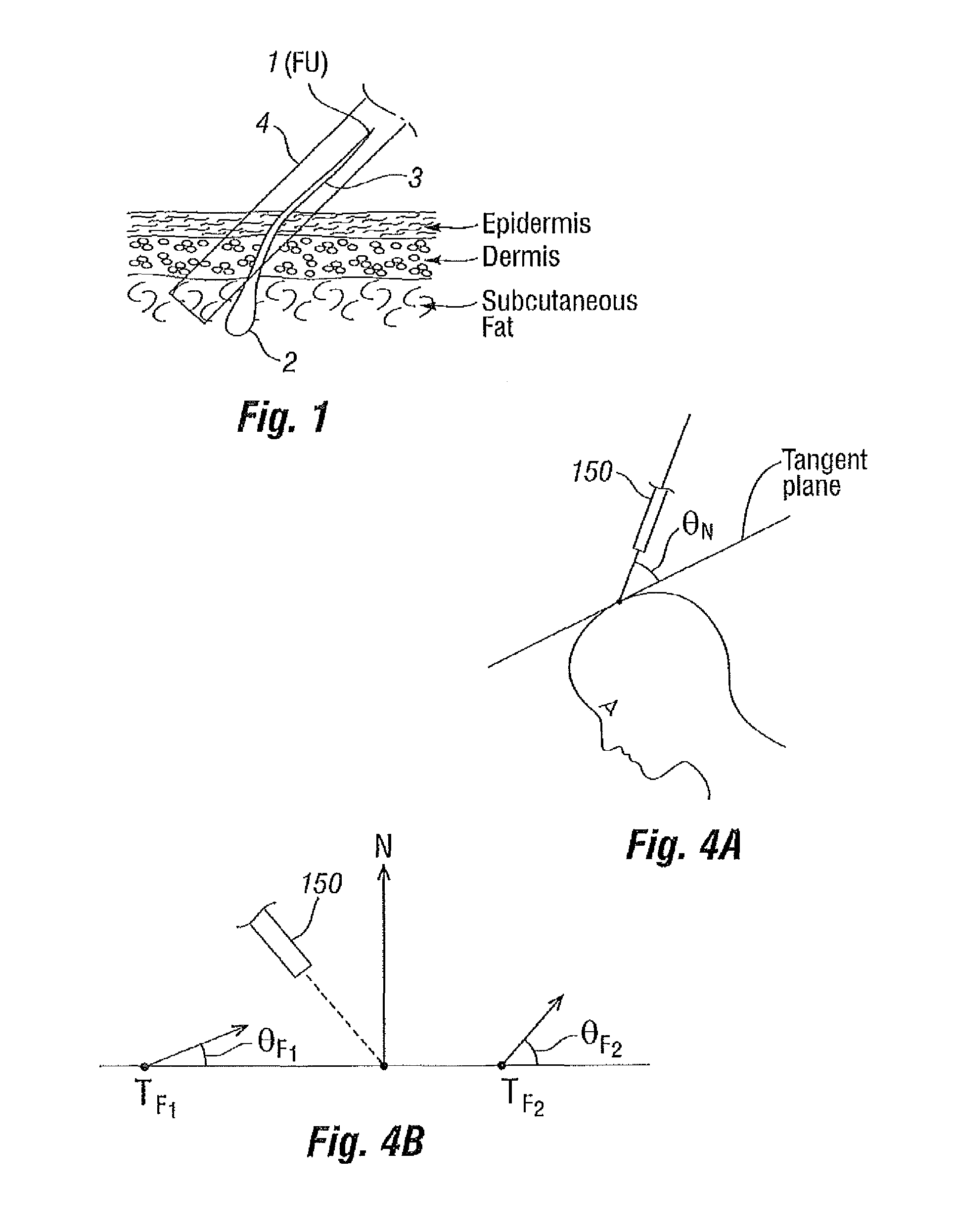 Systems and methods for harvesting and implanting hair using image-generated topological skin models