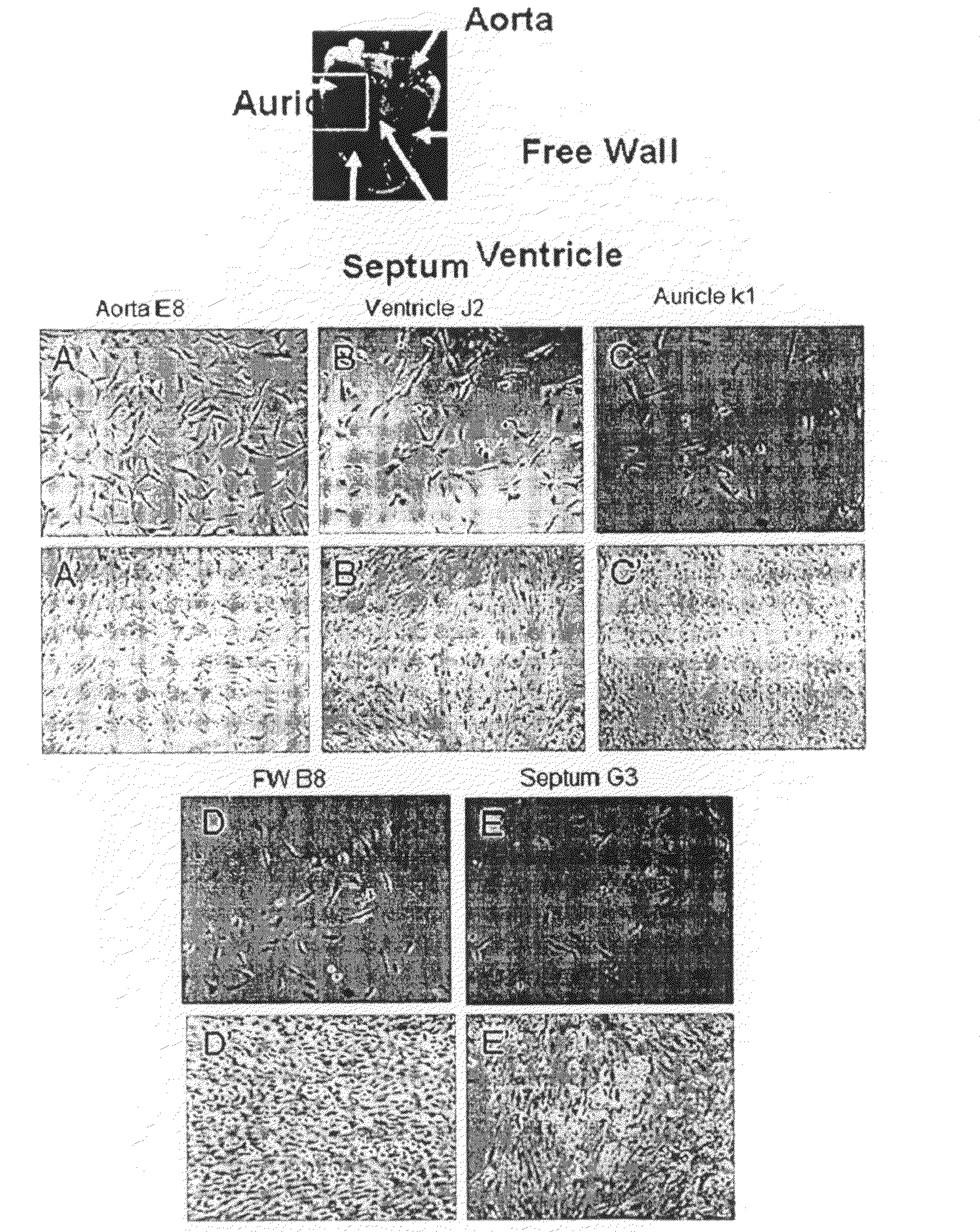 Skeletal muscle periangioblasts and cardiac mesangioblasts, method for isolation and uses thereof