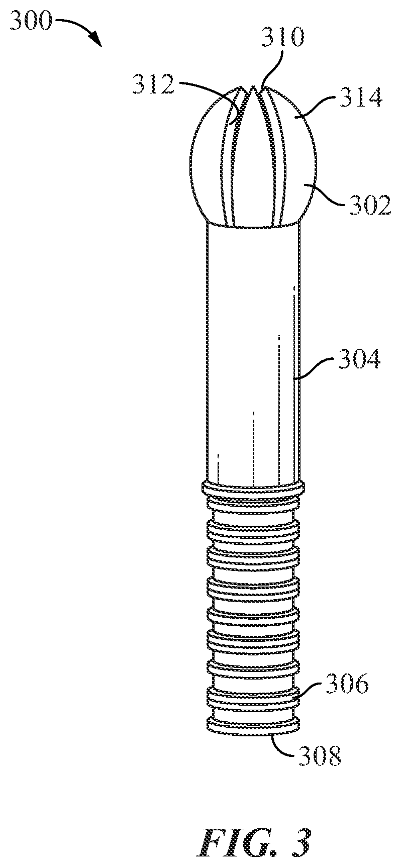 Round tip vaginal insert system and method of using the same