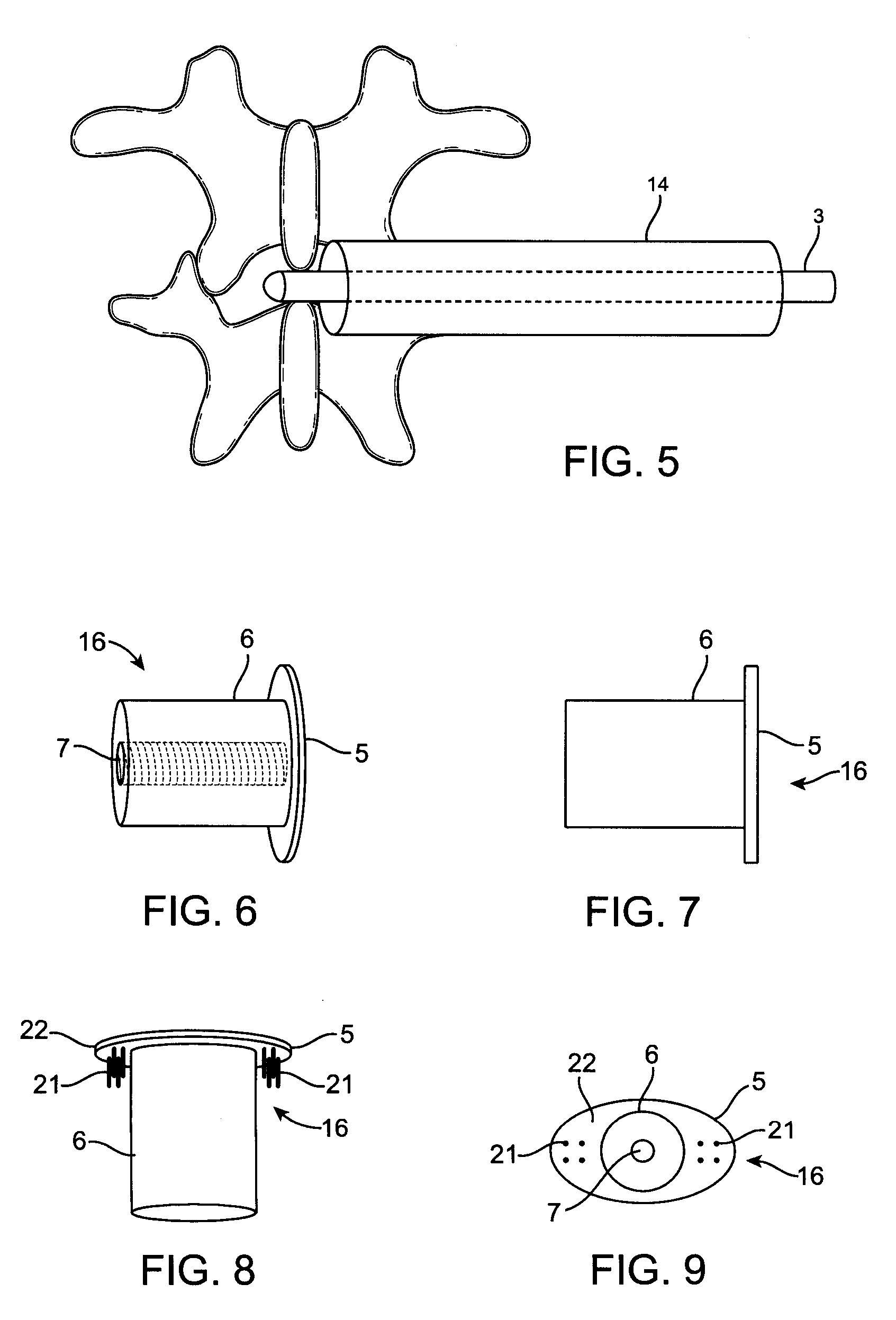 Implant device and method for interspinous distraction