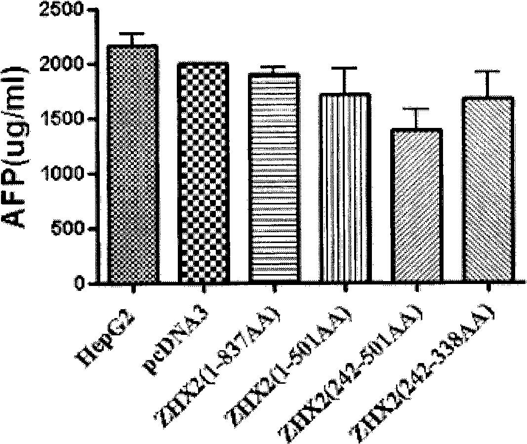 Core fragment of human ZHX2 transcription factor and application thereof