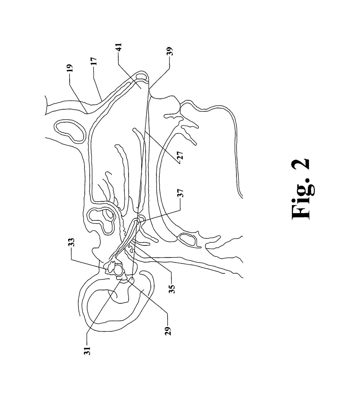 Device and method for administration of compositions to the eustachian tube