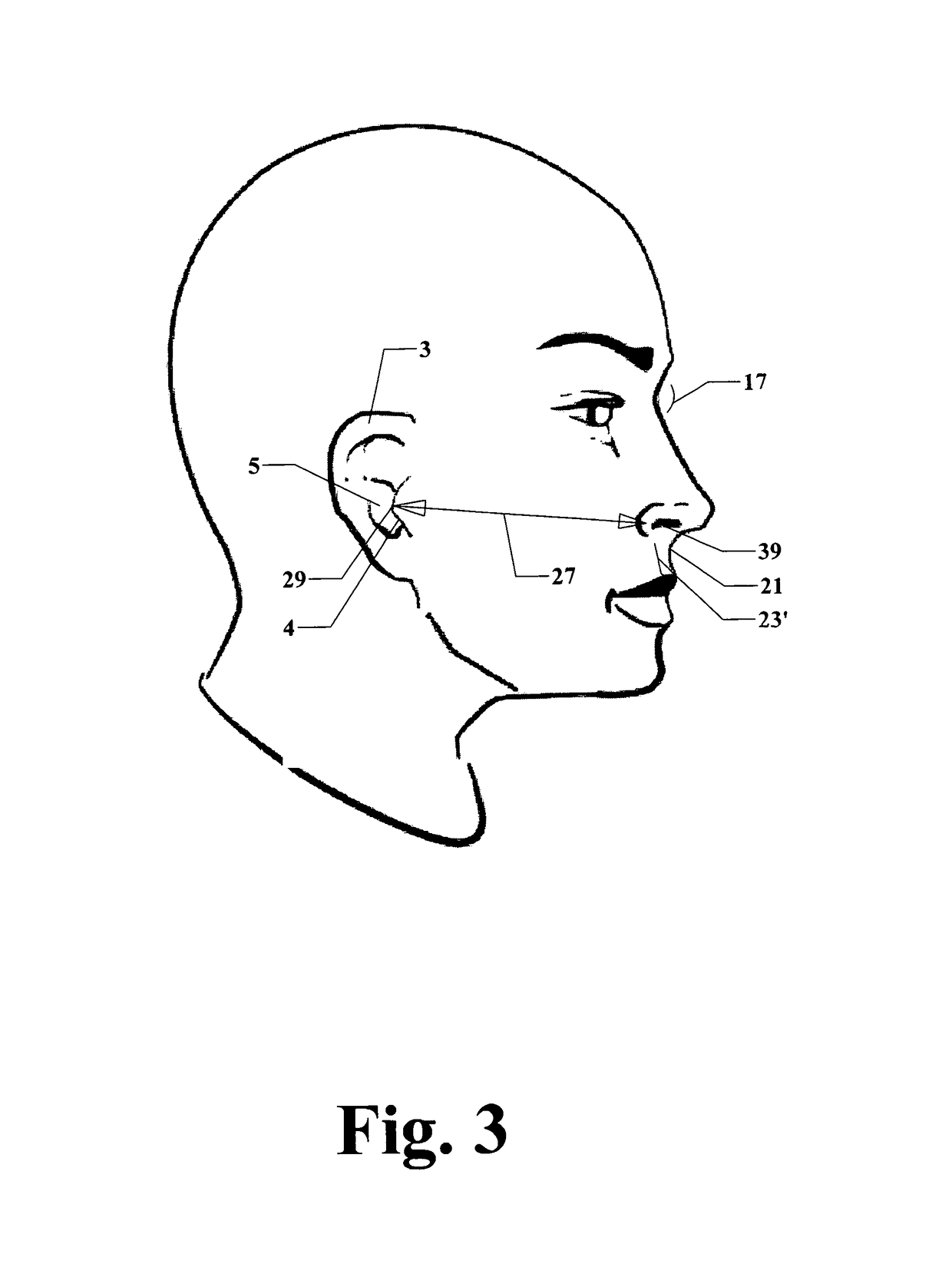 Device and method for administration of compositions to the eustachian tube