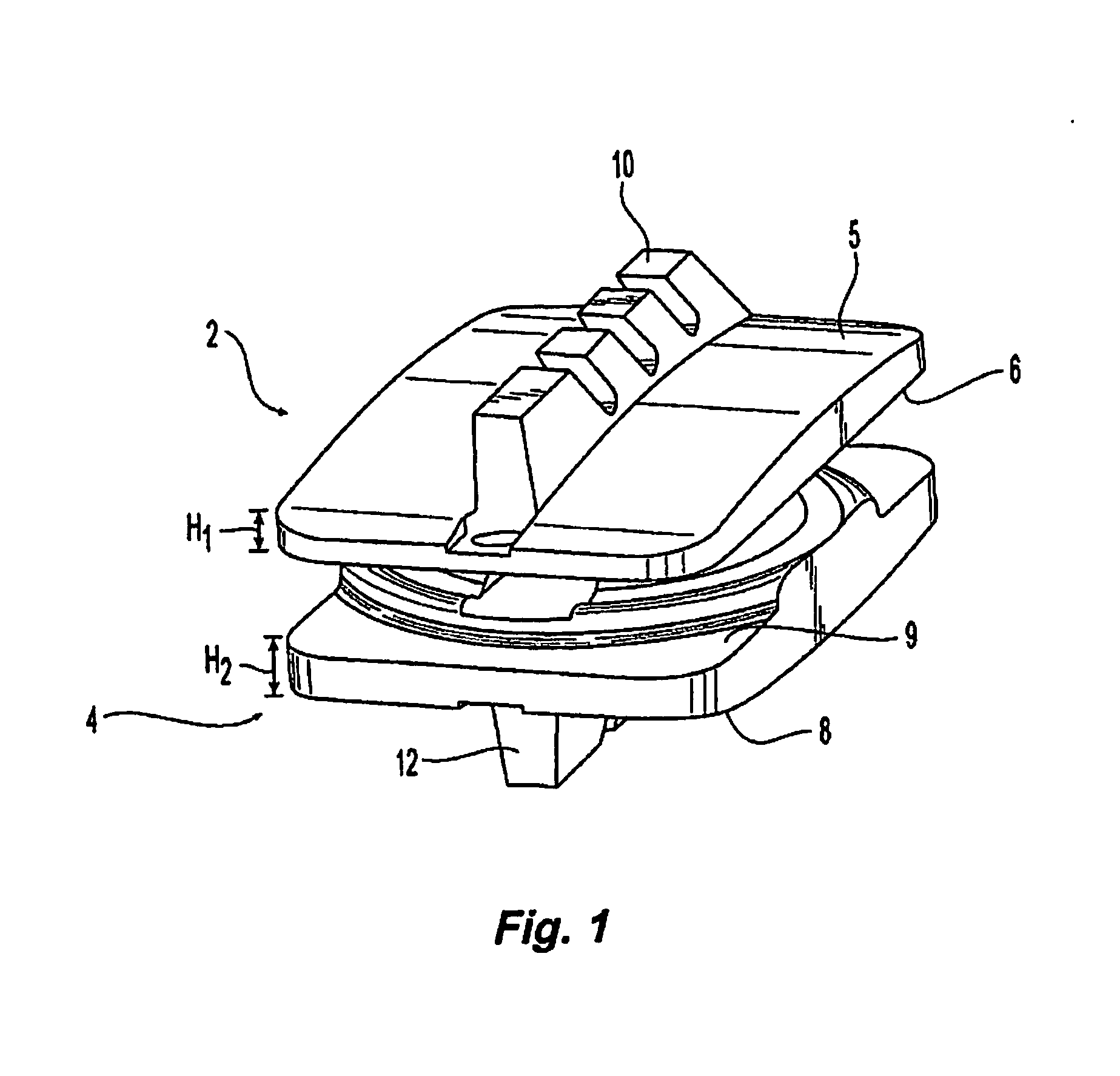 Prosthetic Spinal Disc Replacement and Methods Thereof