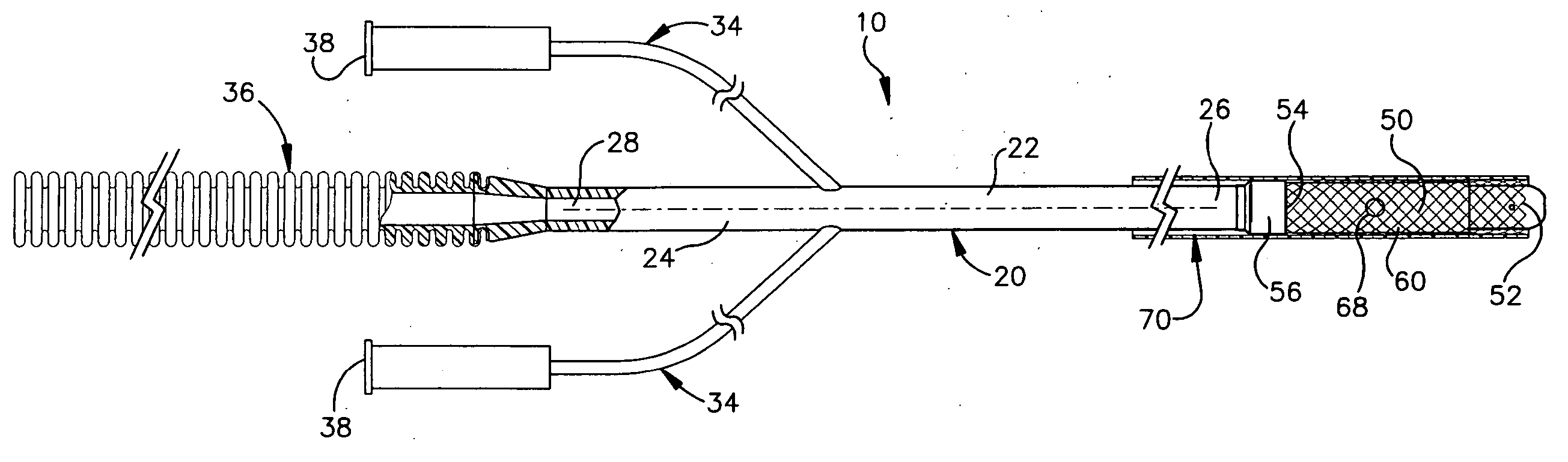 Apparatus and method for auto-retroperfusion of a coronary vein