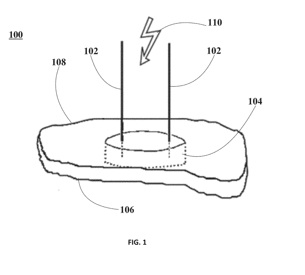 Ablation of Myocardial Tissues with Nanosecond Pulsed Electric Fields