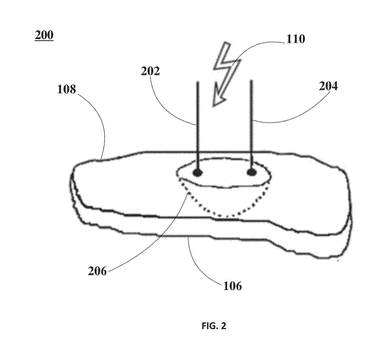 Ablation of Myocardial Tissues with Nanosecond Pulsed Electric Fields