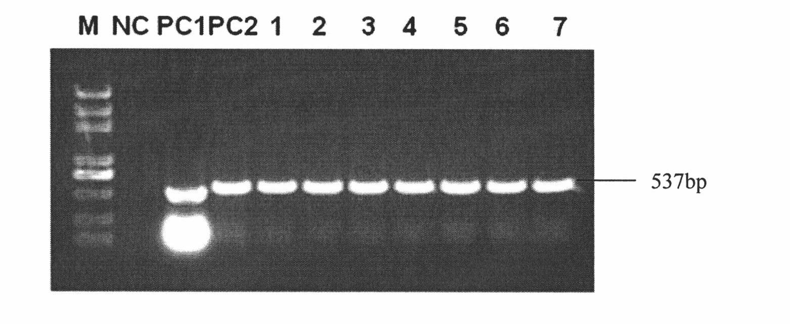 Method for cultivating anti-cyanosis transgenic cotton and special expression vector thereof