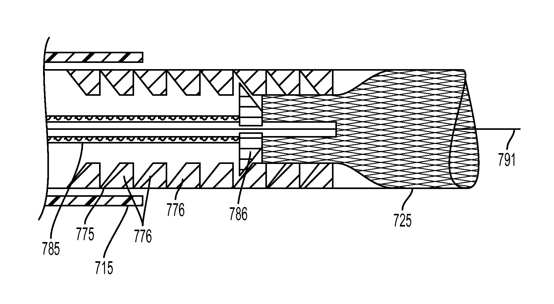 Stent Deployment Device and Methods for Use