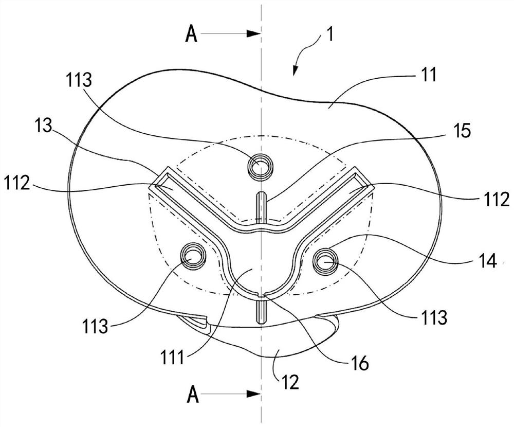 Modification assembly for tibial plateau osteotomy surface