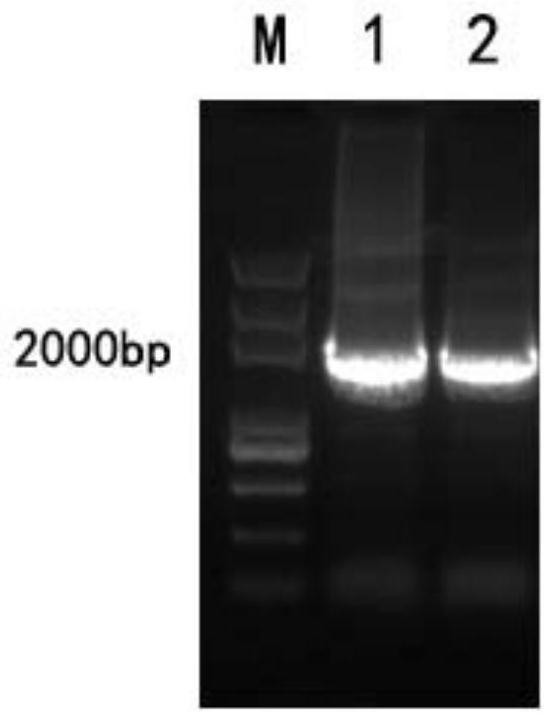 Human extracellular matrix protein 1 detection kit