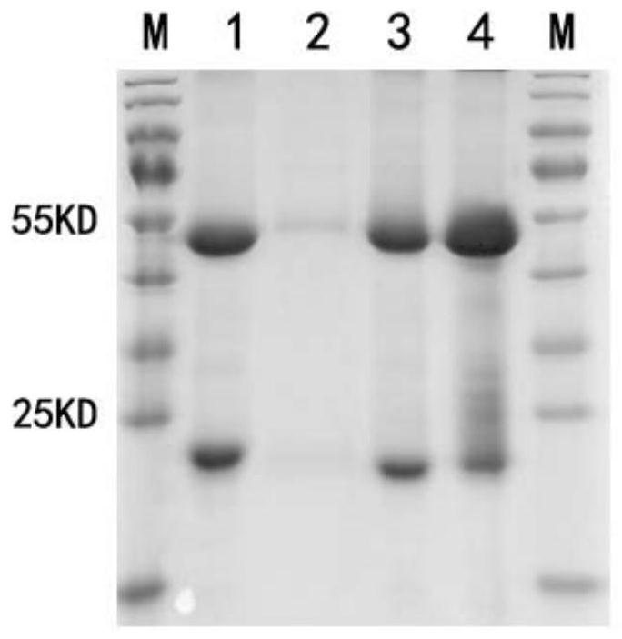 Human extracellular matrix protein 1 detection kit