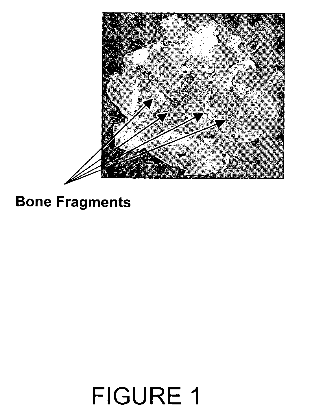 Method to detect bone fragments during the processing of meat or fish