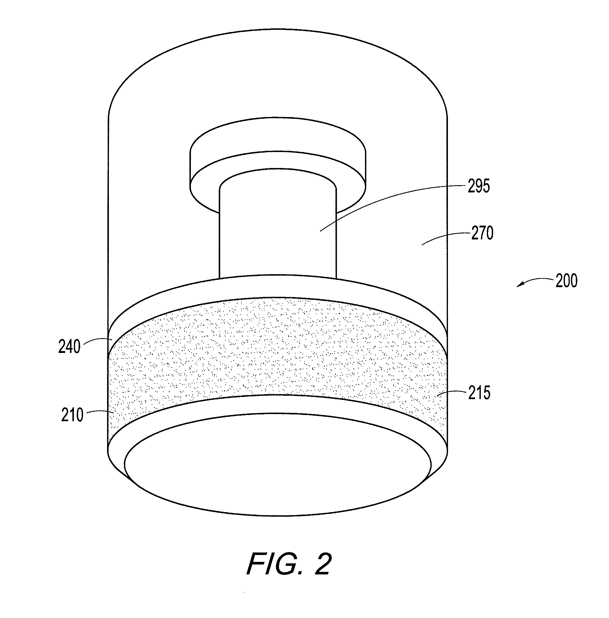 Hybrid polymer/metal plug for treating chondral defects