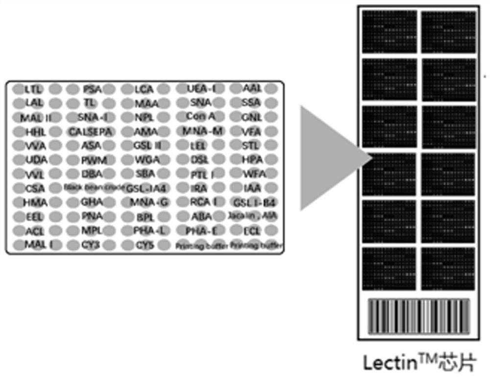 Application of construction of liver cancer identification tool based on specific lectin combination and alpha fetoprotein