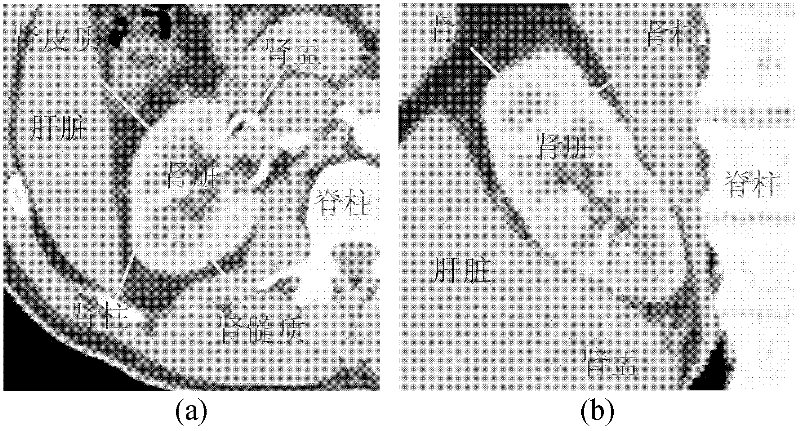 Method for segmenting renal cortex images