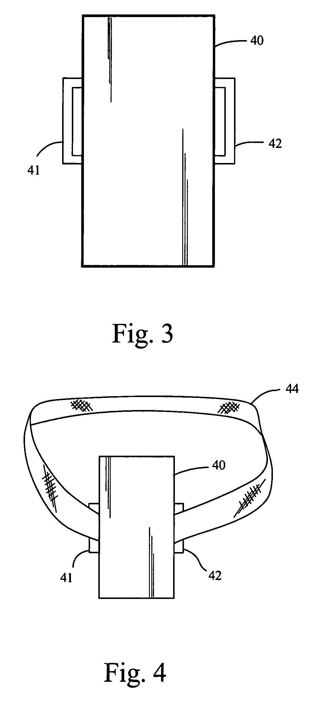 Partially implantable system for the electrical treatment of abnormal tissue growth