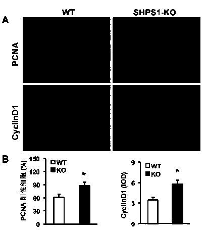 Functions and application of SHPS1 in treatment of post-vascular injury restenosis