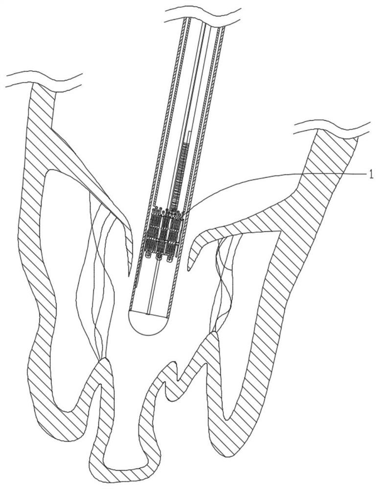 Multi-dimensional fixed heart valve prosthesis