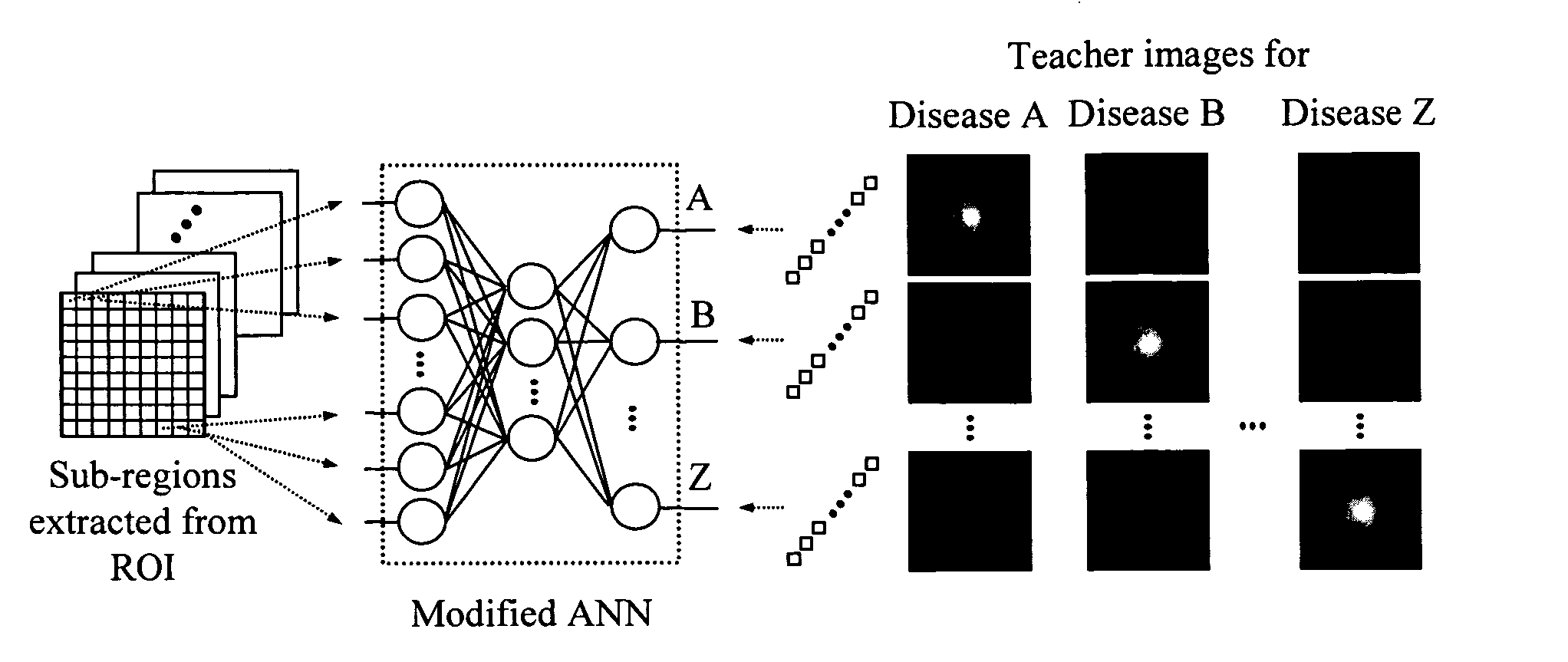 Computerized scheme for distinction between benign and malignant nodules in thoracic low-dose CT