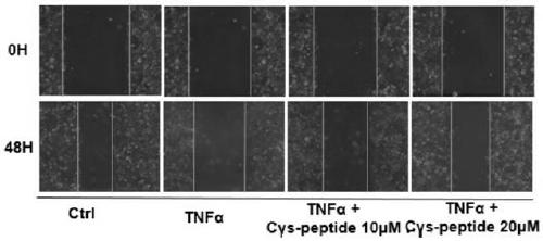 Novel peptidome for improving pre-eclampsia placental dysfunction