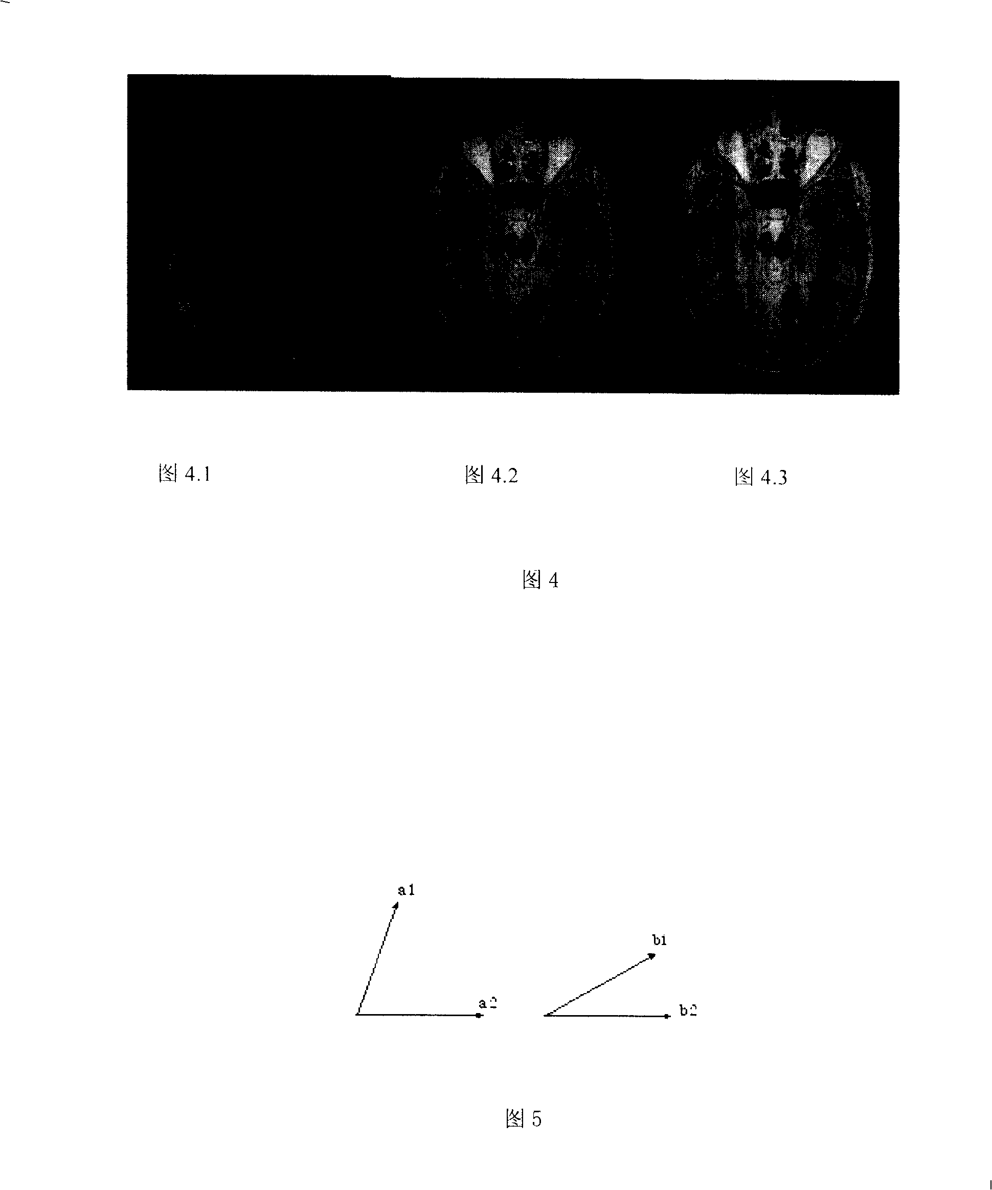 Multi- resolution non-rigid head medicine image registration method based on image edge