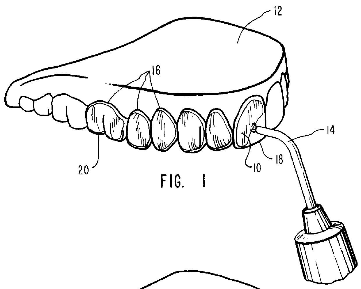 Methods for treating a person's teeth using sticky dental compositions in combination with passive-type dental trays