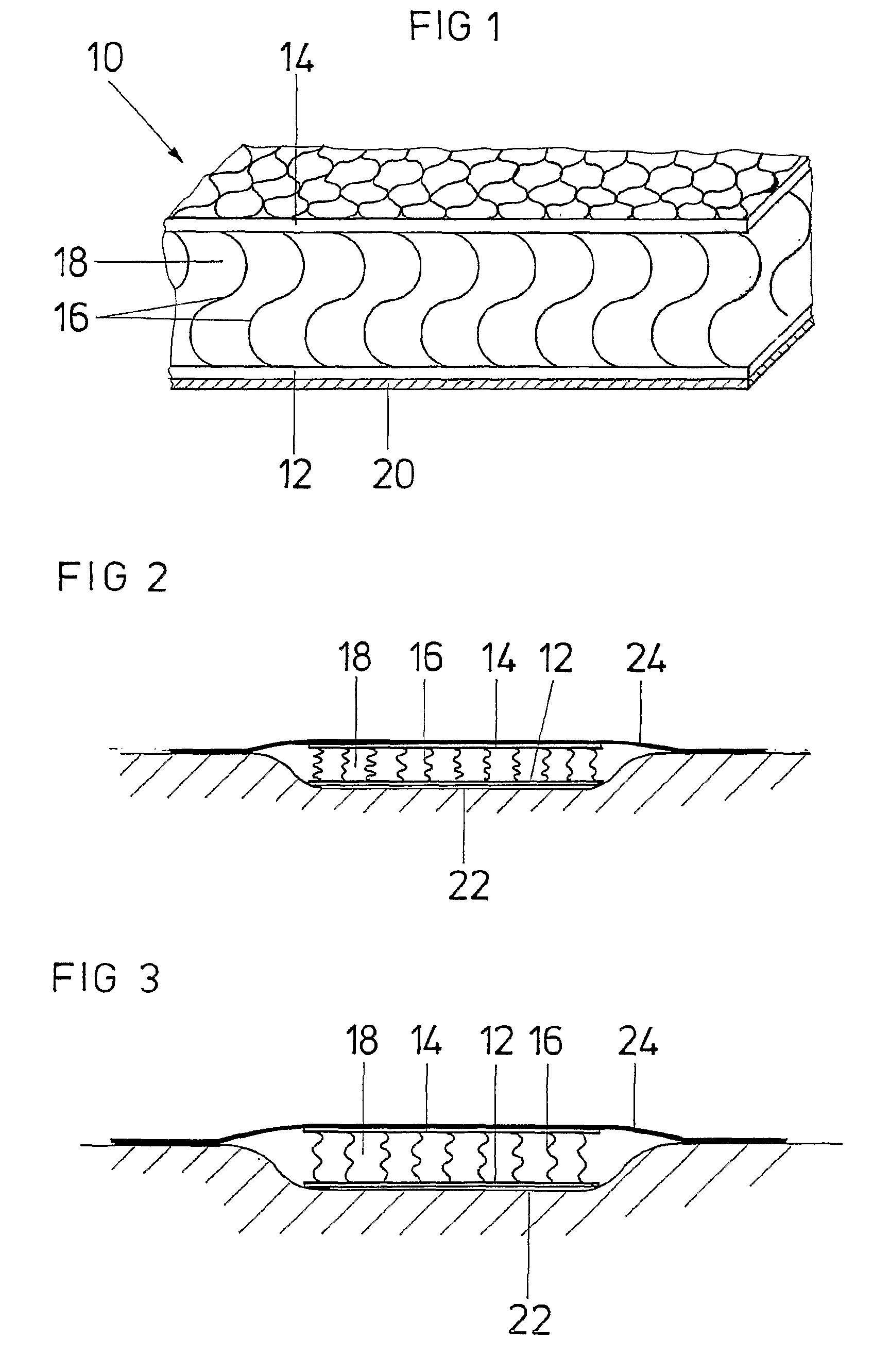 Wound treatment device
