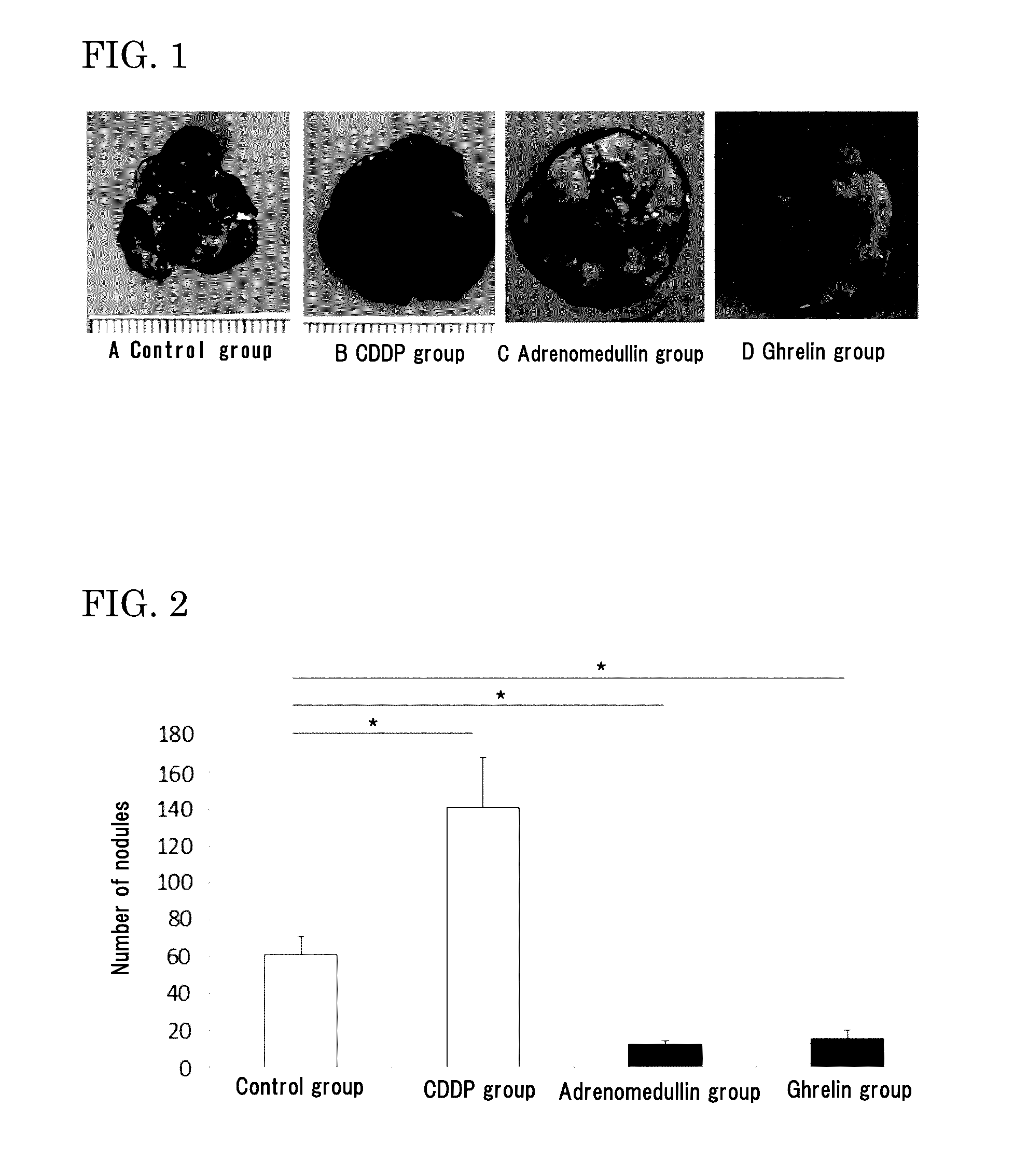 Medicinal agent for suppressing malignant tumor metastasis