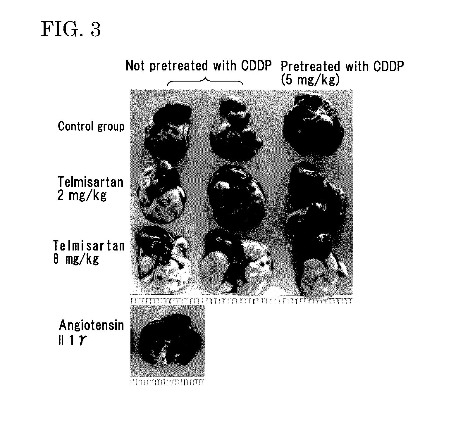 Medicinal agent for suppressing malignant tumor metastasis