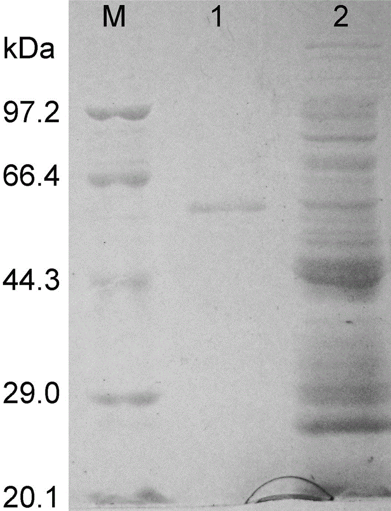 Achromobacter xylosoxidans glutamine synthetase gene and application thereof