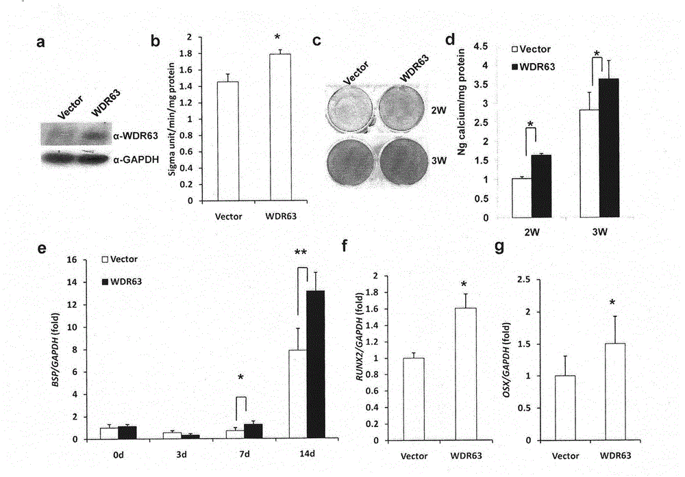 Regulating method of WDR63 gene in osteogenic differentiation and odontogenic differentiation processes of mesenchymal stem cell