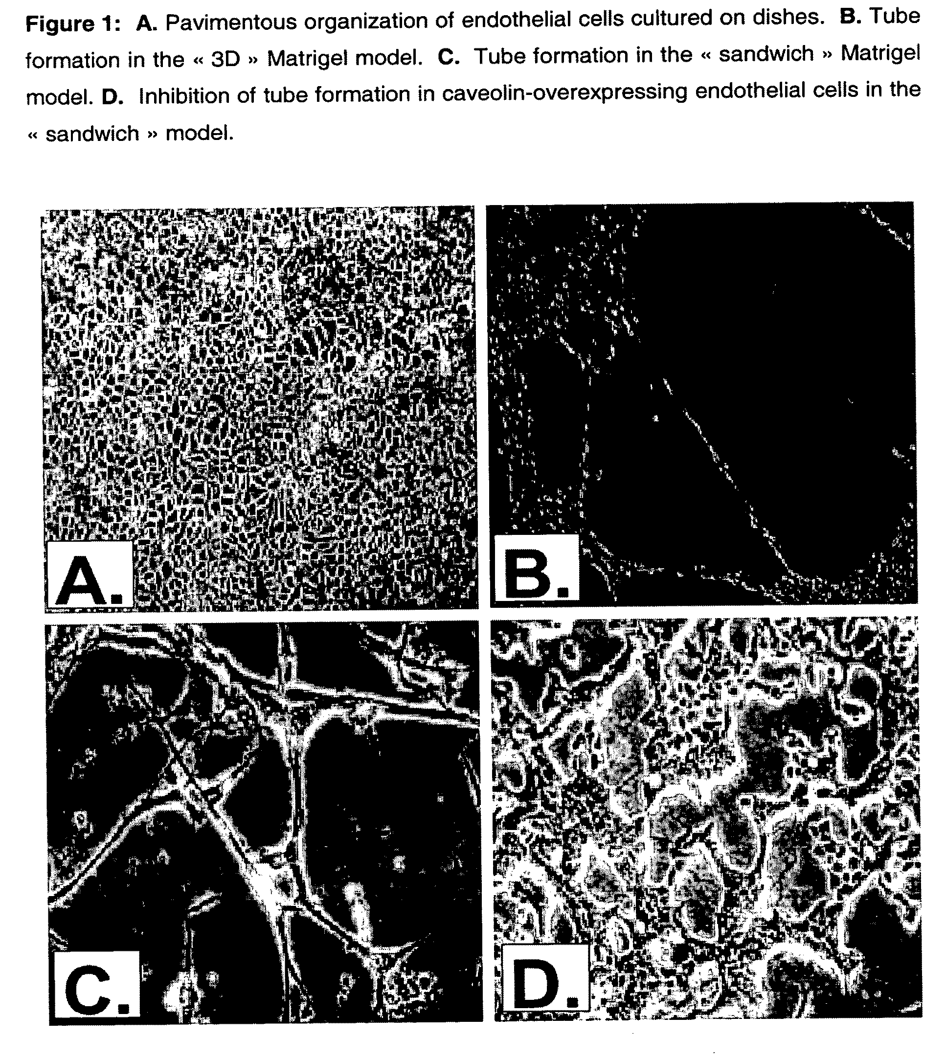 Novel pharmaceutical compositions for modulating angiogenesis