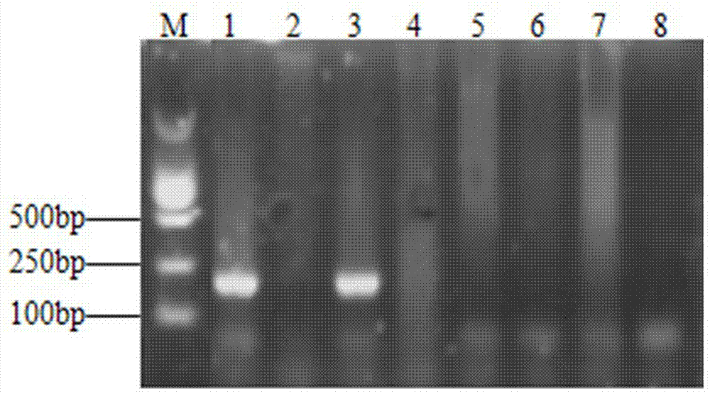 Enterobacter aerogenes specific PCR (polymerase chain reaction) detection primer