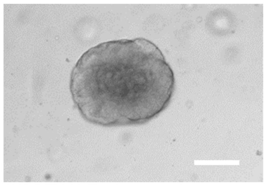 Method for entrapment of chemotherapeutic drug by using autologous organoid-derived microvesicles of tumor patient and application of chemotherapeutic drug