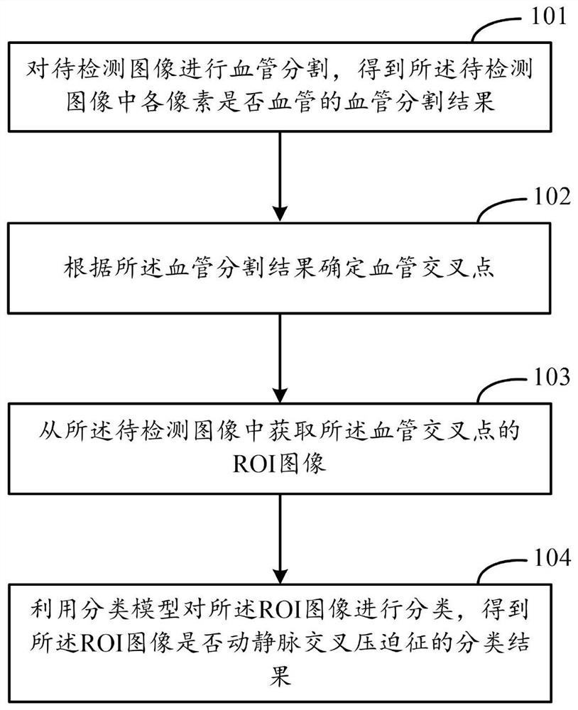 Arteriovenous cross compression symptom detection method and device, electronic equipment and readable storage medium