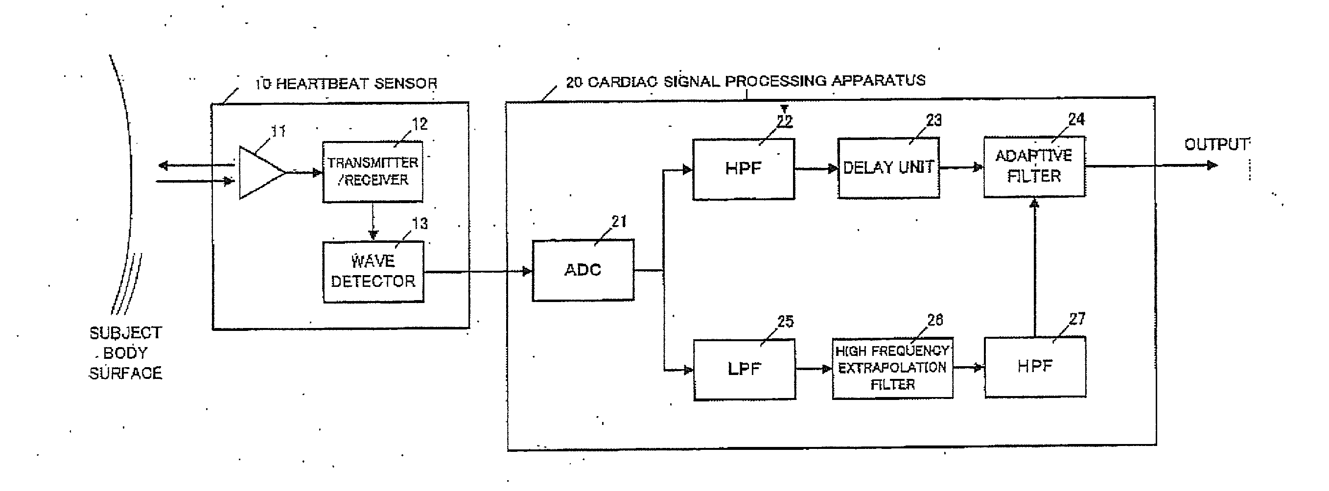 Cardiac signal processing apparatus and cardiac signal processing method