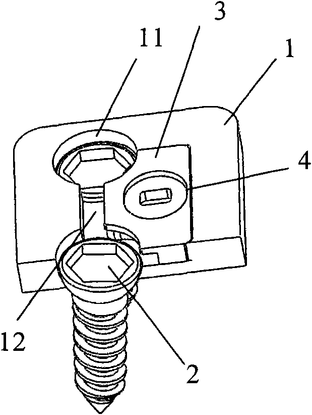 Locking device of anterior cervical vertebra steel plate
