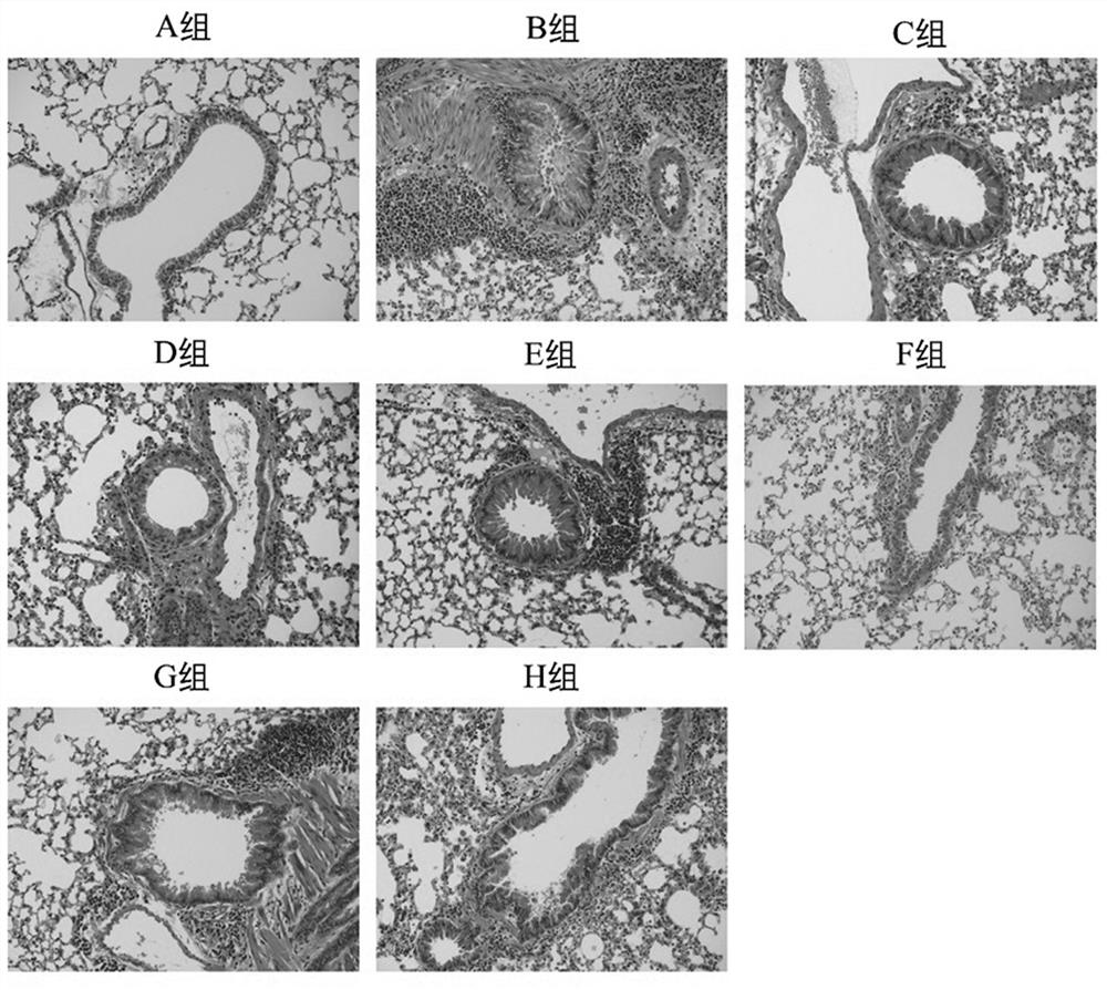 Thermal inactivation clostridium butyricum for preventing or treating asthma and preparation method of thermal inactivation clostridium butyricum