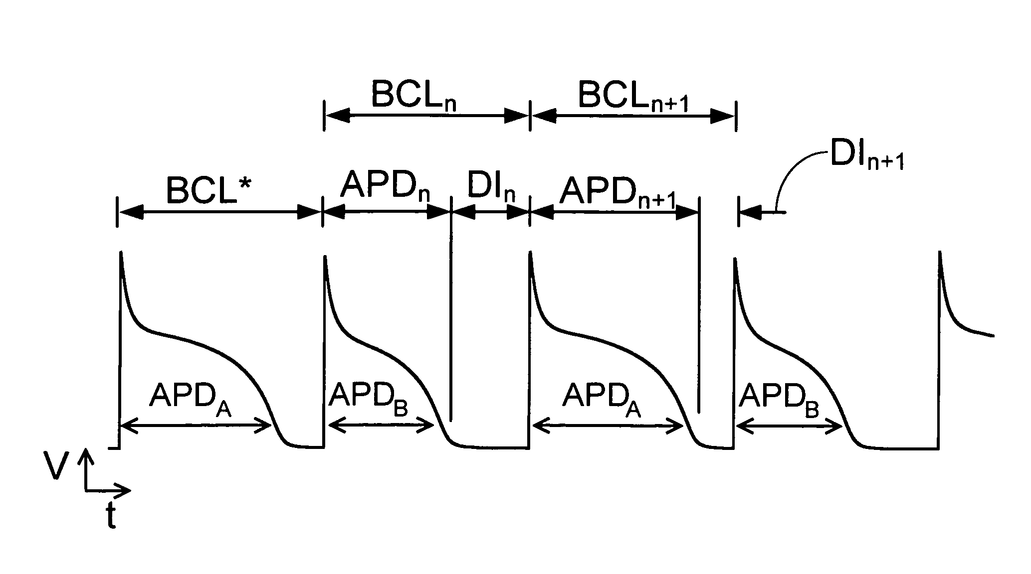 Adaptive diastolic interval control of action potential duration alternans