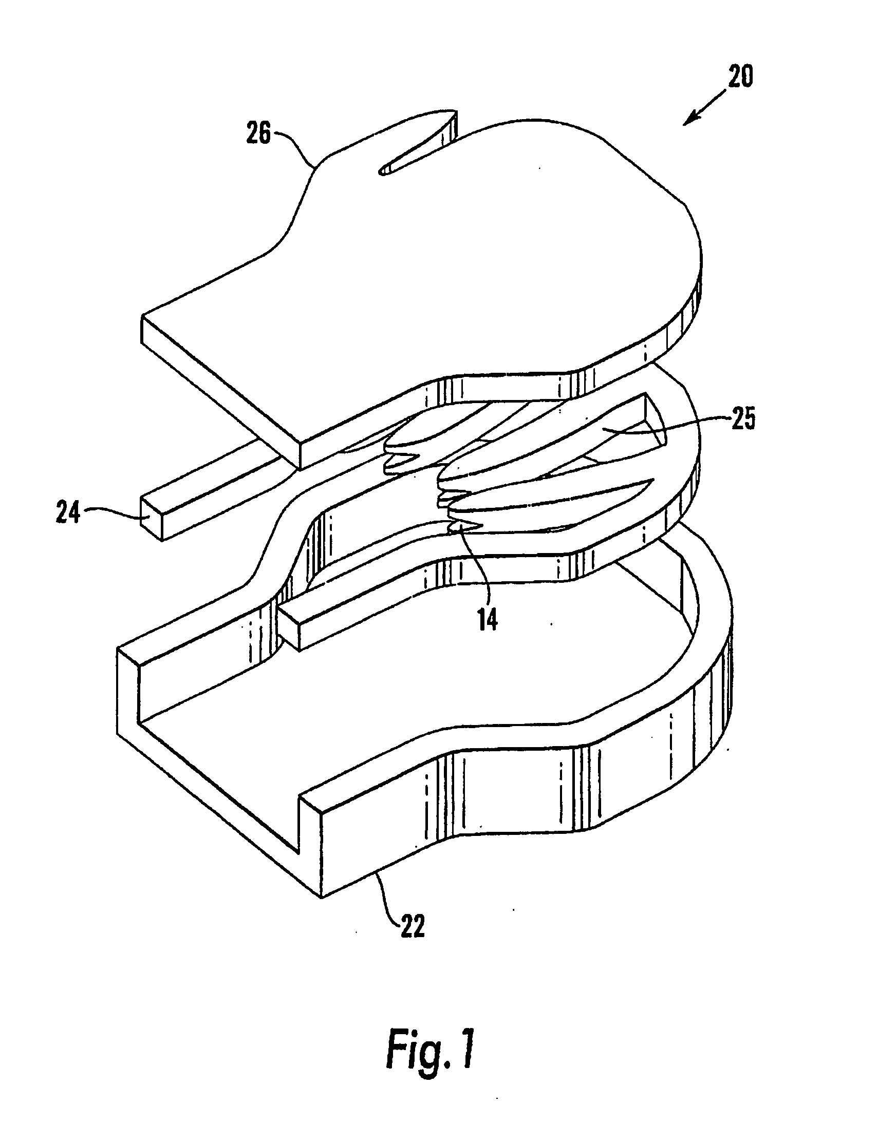 Wound treatment apparatus employing reduced pressure