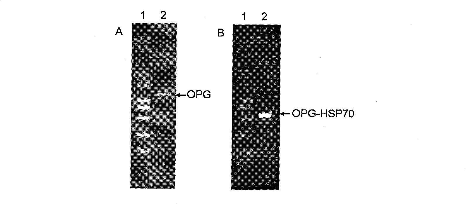 Preparation and use of OPG-HSP70 fusion protein