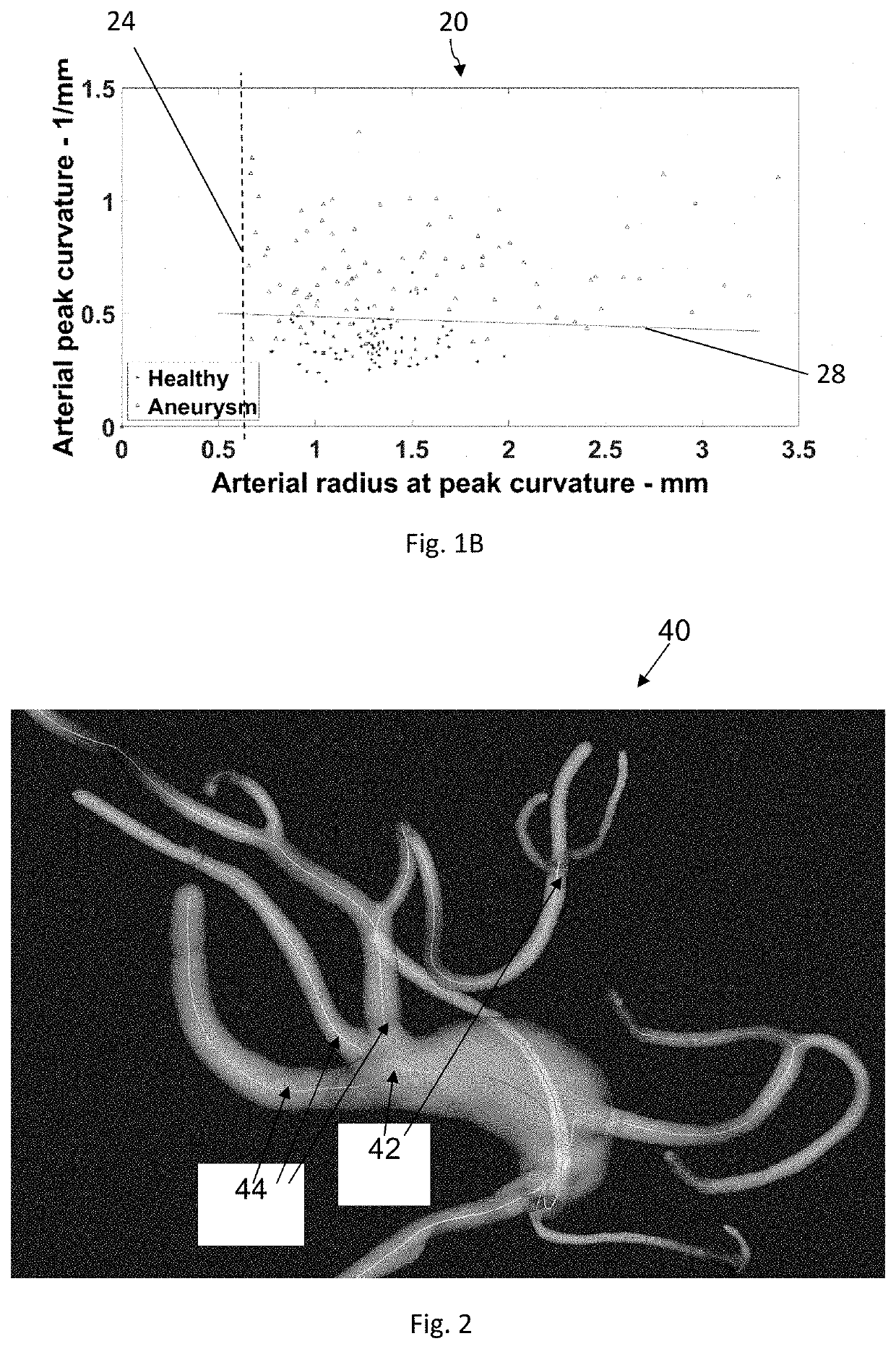 Method and system for monitoring a condition of cerebral aneurysms