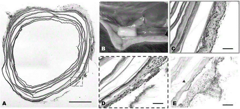 Construction of autologous tissue engineering blood vessel by using large-aperture parallel polycaprolactone electrospun cotton