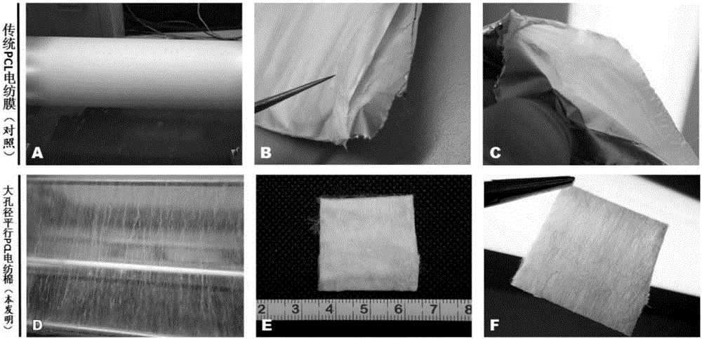 Construction of autologous tissue engineering blood vessel by using large-aperture parallel polycaprolactone electrospun cotton