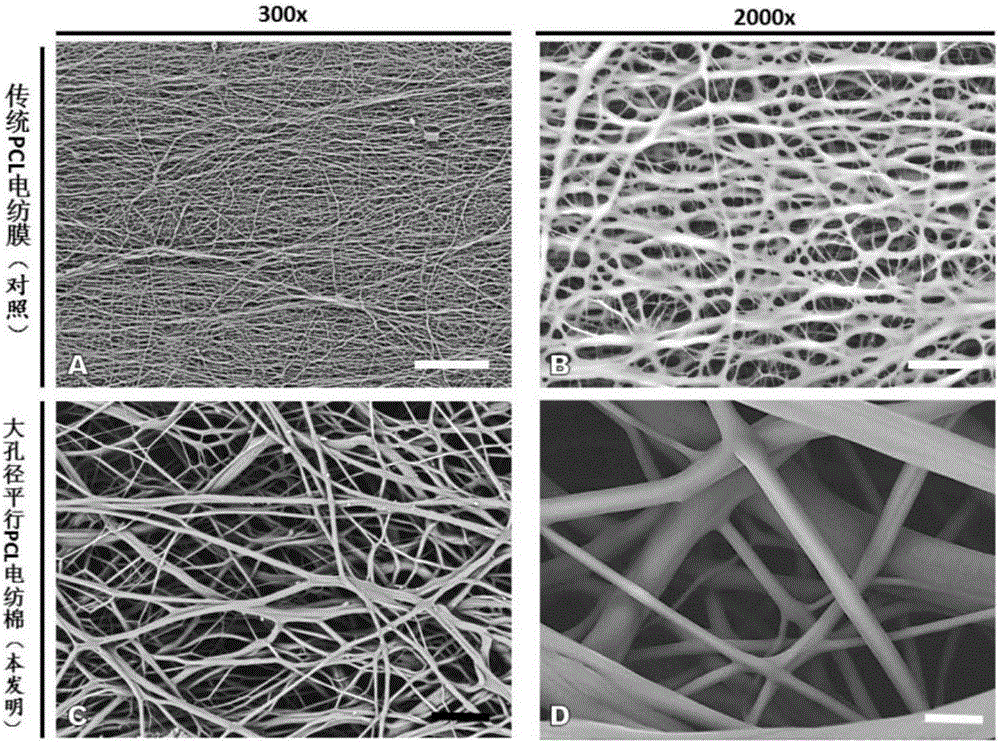 Construction of autologous tissue engineering blood vessel by using large-aperture parallel polycaprolactone electrospun cotton