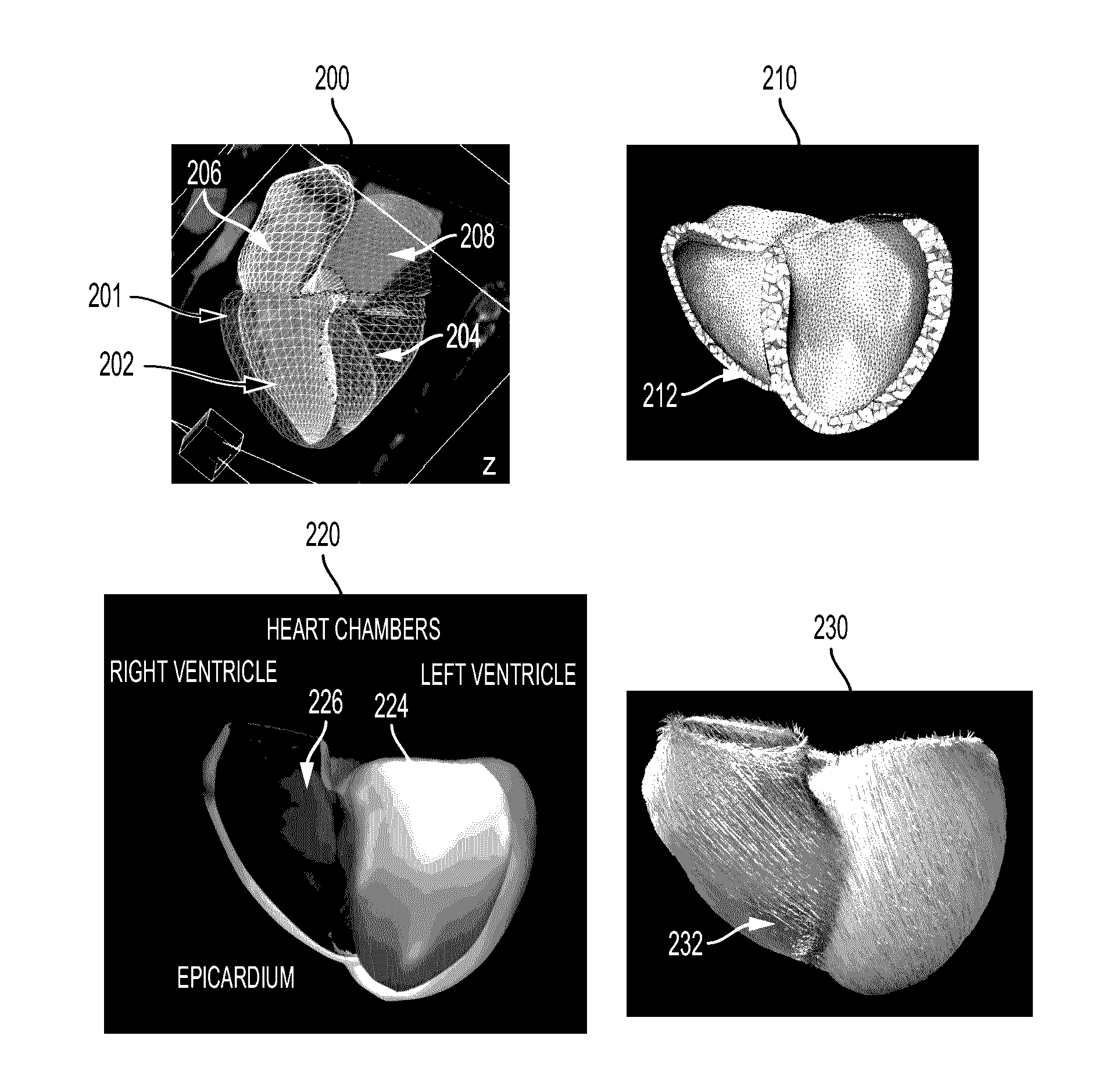 System and Method for Non-Invasively Estimating Electrophysiological Maps and Measurements from Cardio-Thoracic 3D Images and Electrocardiography Data