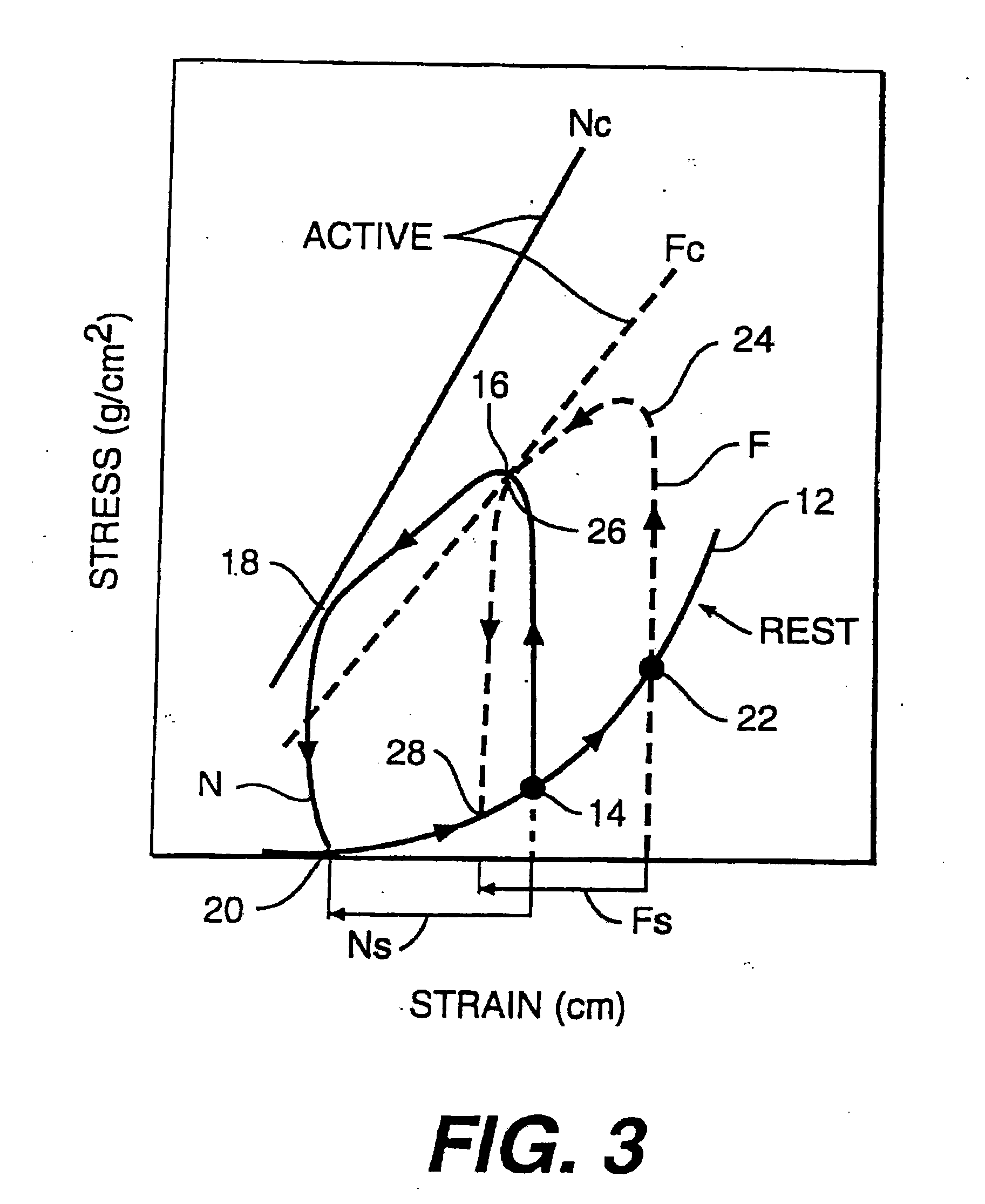 Heart Wall Tension Reduction Apparatus and Method