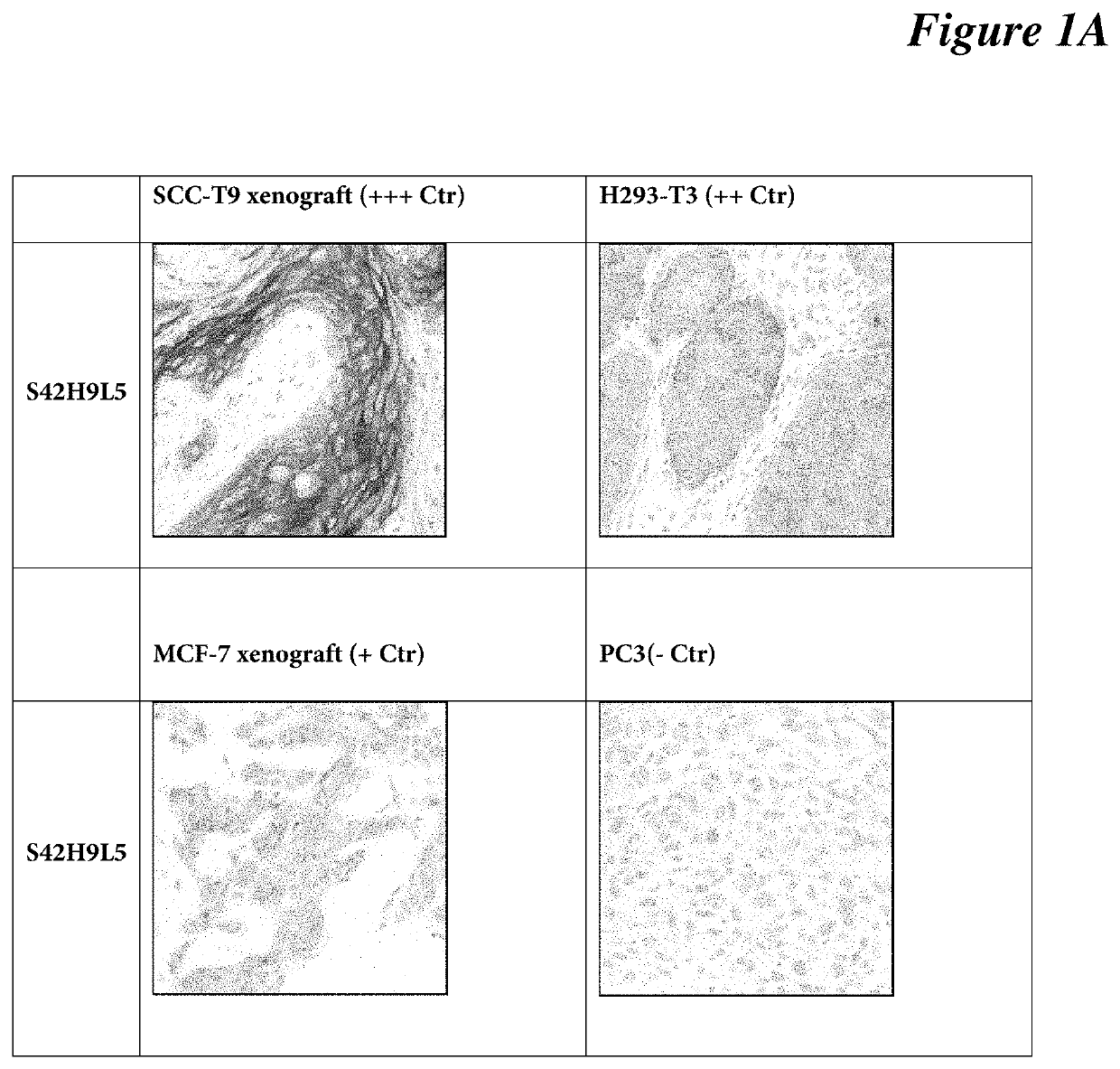 Antibodies, compositions, and immunohistochemistry methods for detecting C4.4a