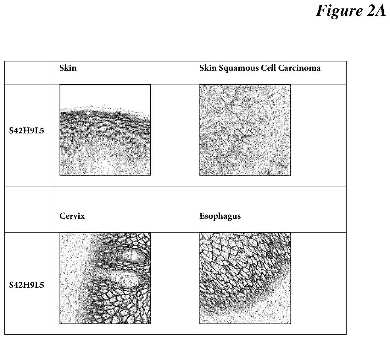 Antibodies, compositions, and immunohistochemistry methods for detecting C4.4a